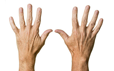 wrinkles